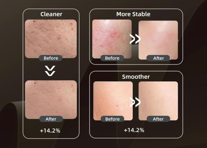 Radiéa Skin Renewal Mask
