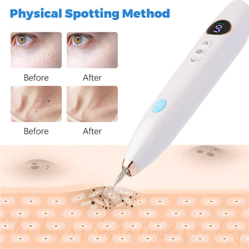 GlowErase™  Spot Removal Pen