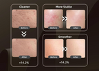 Radiéa Skin Renewal Mask