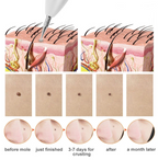 GlowErase™  Spot Removal Pen